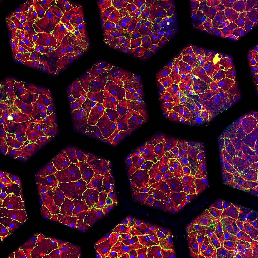 Eingefärbte Patientenzellen, die auf einer «Lunge auf Chip» der zweiten Generation kultiviert wurden. © Pauline Zamprogno, ARTORG Center for Biological Engineering Research