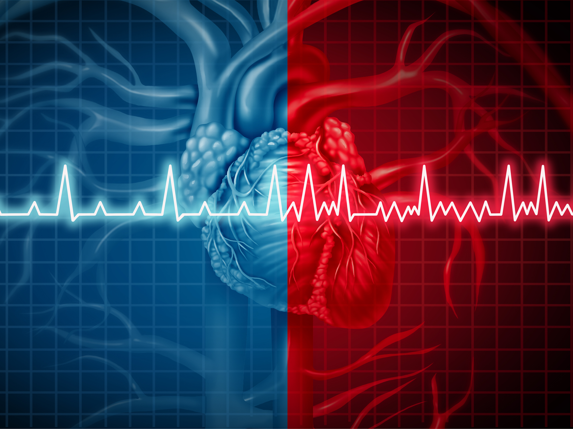 Vorhofflimmern ist die häufigste Herzrhythmusstörung. Sie tritt öfter bei älteren Menschen (über 10% über 80 Jahre) auf. Studiert wurden die Phänotypen: Dauer des Auftretens (nur vorübergehend oder dauerhaft vorhanden) und Wahrnehmung durch die Betroffenen (symptomatisch / asymptomatisch).