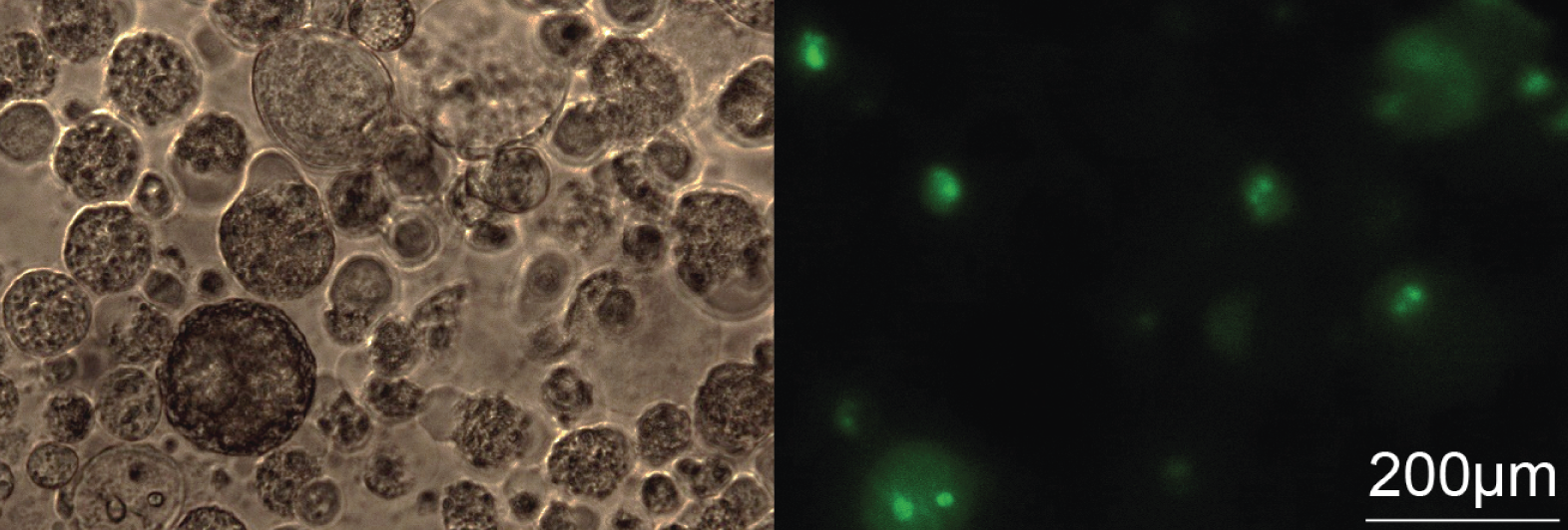 Mikroskopiebilder von dreidimensionalen Lungenkrebsspheroiden transfiyziert mit ASOs, welche grün fluoreszierend markiert sind.