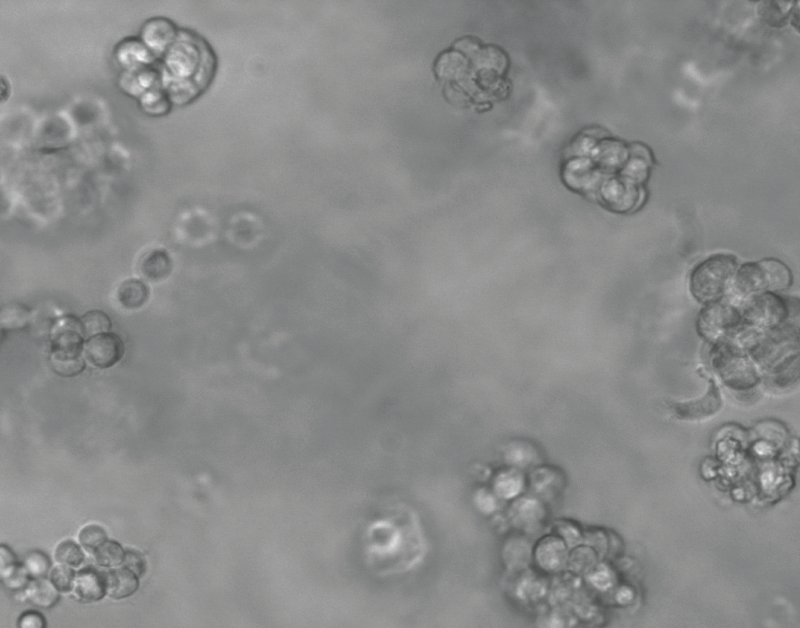 Repräsentatives Mikroskopiebild von dreidimensionalen Organoiden, welche aus Lungenkrebsgewebe von Patienten gezüchtet wurde.