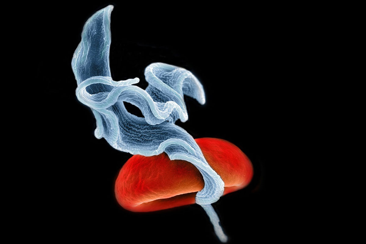 Das Bild zeigt eineRasterelektronenmikroskop-Aufnahme zweier Trypanosomen (blau), die im Blut schwimmen. Bei der runden Struktur handelt es sich um ein rotes Blutkörperchen.