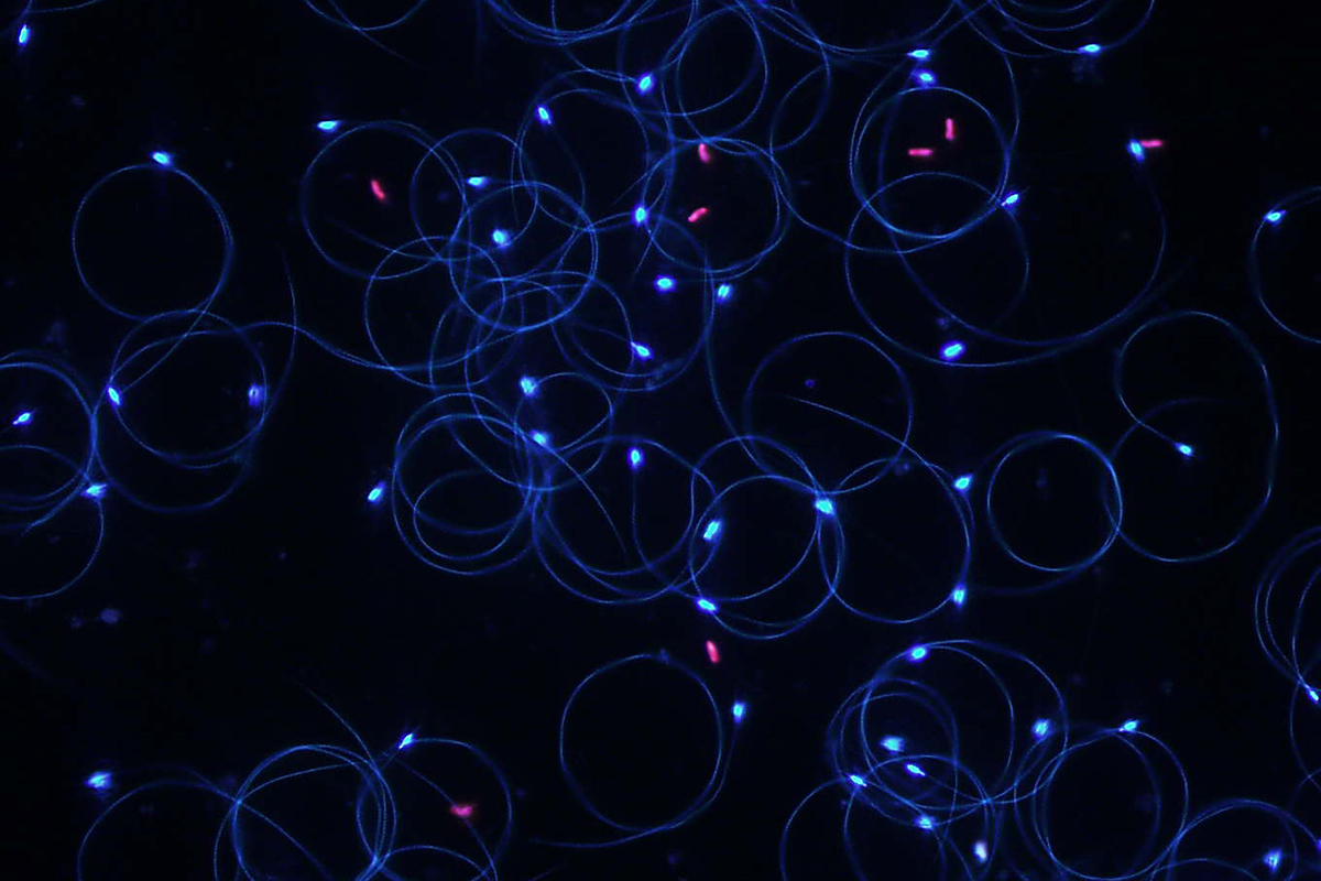Das Bild zeigt eine Fluoreszenzmikroskopie-Aufnahme von lebenden (grün-blau gefärbt) und toten (rot gefärbt) Spermien von Drohnen.
