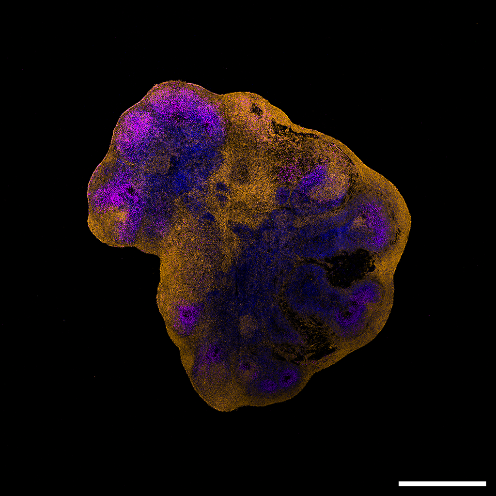 Hirnorganoid, welches nicht mit dem Affenpockenvirus (MPXV) infiziert ist. Die DNA der Zellkerne ist blau gefärbt. Massstab: 1000 μm.