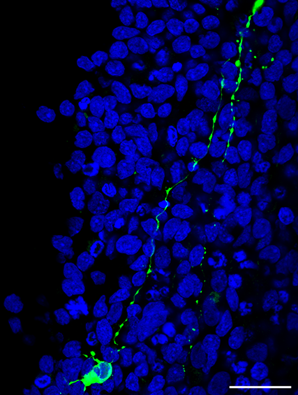 Immunofluoreszenz-Bild mit sogennanten «neuritic beads», welche durch die Infektion mit dem Affenpockenvirus (MPXV) entstehen. Die DNA der Zellkerne ist blau gefärbt. MPXV, welches sich entlang der Neurite ausbreitet, ist grün dargestellt. Massstab: 25 μm.