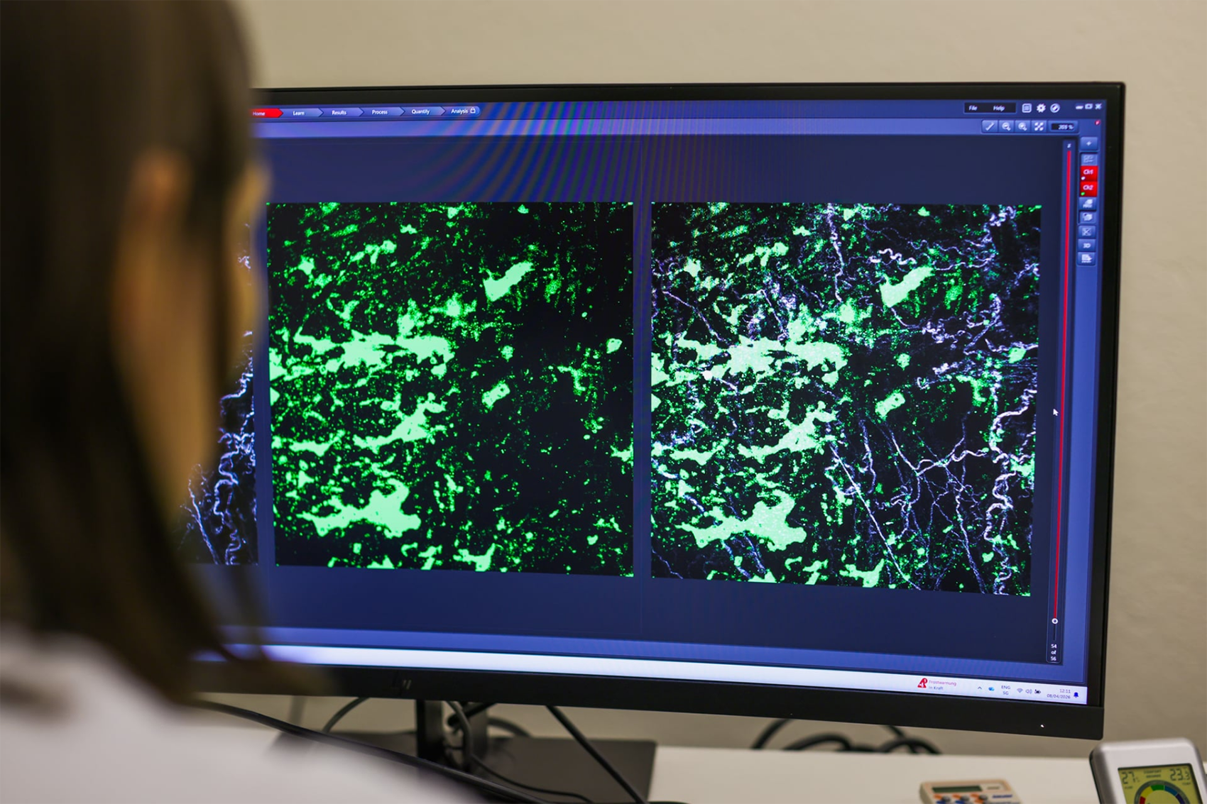 Multiphoton-Intravitalmikroskopie von Hautwunden: Grün fluoreszierendes Fibronektin (Fn1-mEGFP), freigesetzt von aktivierten peritonealen Makrophagen, gelangt über den Blutkreislauf zur entfernten Hautwunde.