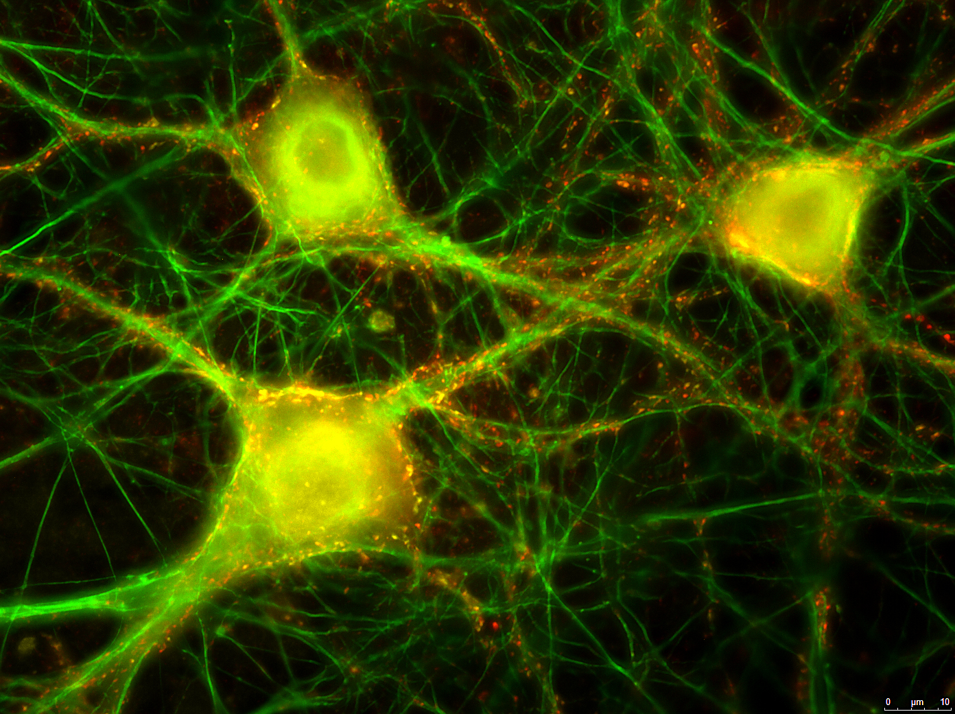 Zu sehen ist eine Vergrösserung der neuronalen Kultur. In grün sind wiederum Strukturen der Neuronen ersichtlich. Die gelben und roten Punkte zeigen die Lokalisation des SV2 Rezeptors, der vom Botulinumtoxin benötigt wird um in die Nervenzelle zu gelangen. © Stephen Jenkinson, Institut für Infektionskrankheiten.