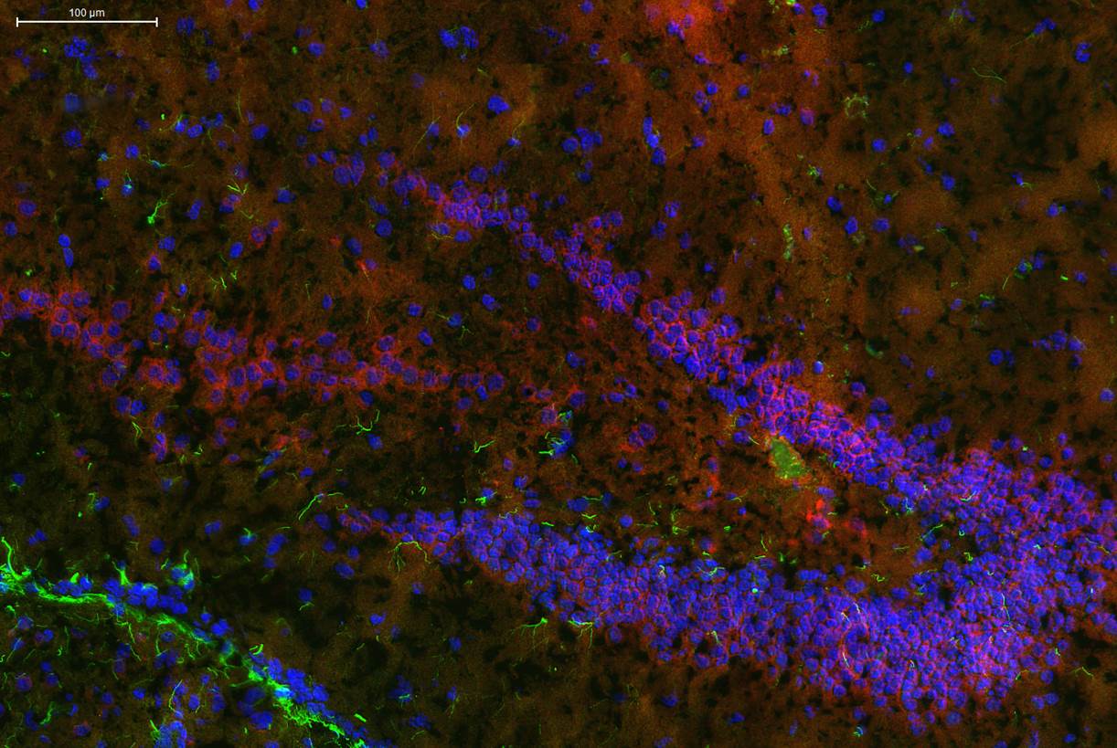 Der Gyrus dentatus im Hippocampus mit fluoreszierendem Endocannabinoid-System in Neuronen