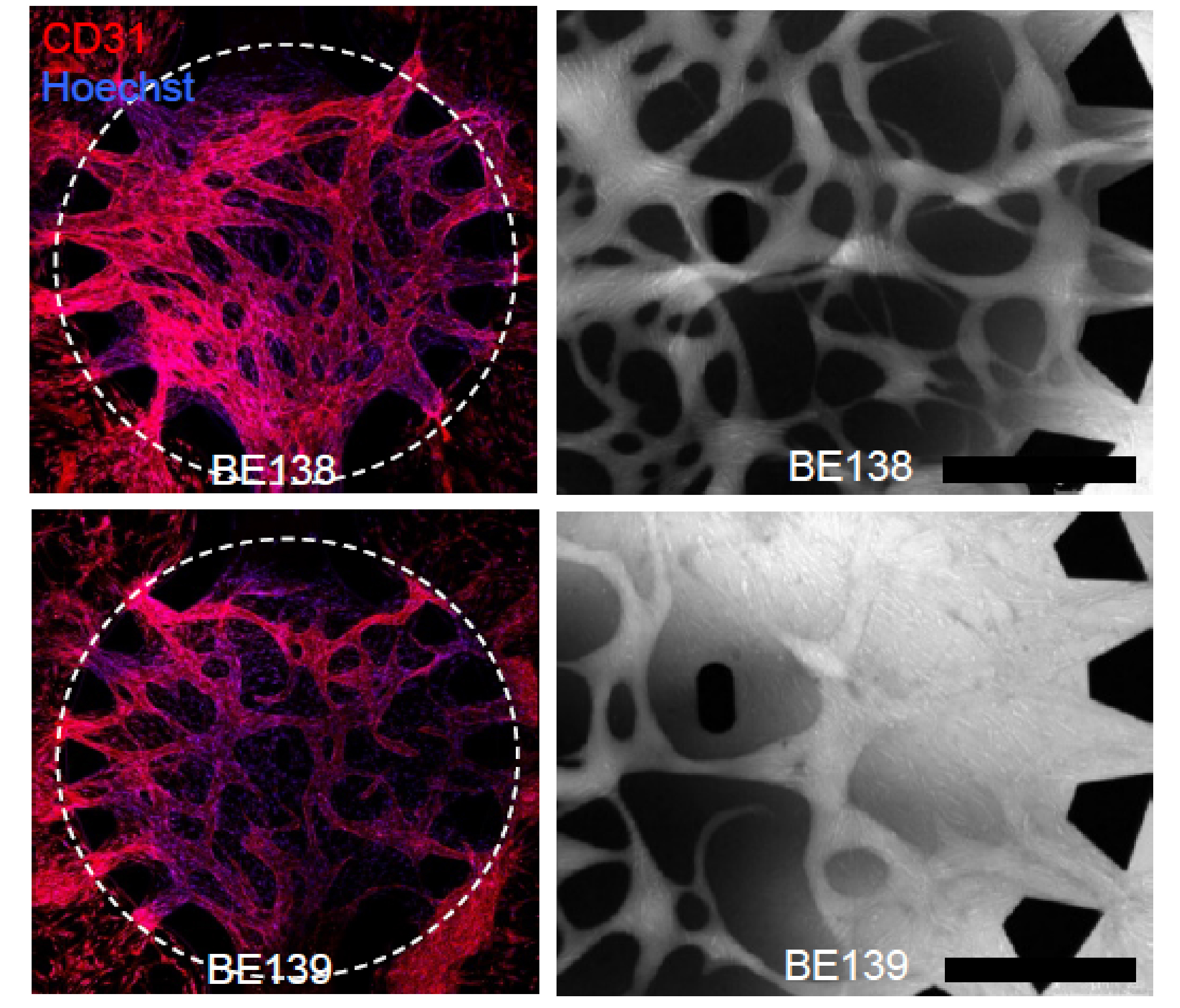 Fluoreszenzmikroskopie-Bilder von Blutgefässen, die von Perizyten abgedichtet werden. Die obere Reihe zeigt Blutgefässe mit Perizyten aus normalem Lungengewebe, verglichen zu Blutgefässen mit Perizyten aus Tumorgewebe (unten). Die Gefässe unten sind deutlich undichter. © Inselspital Bern/Universität Bern.