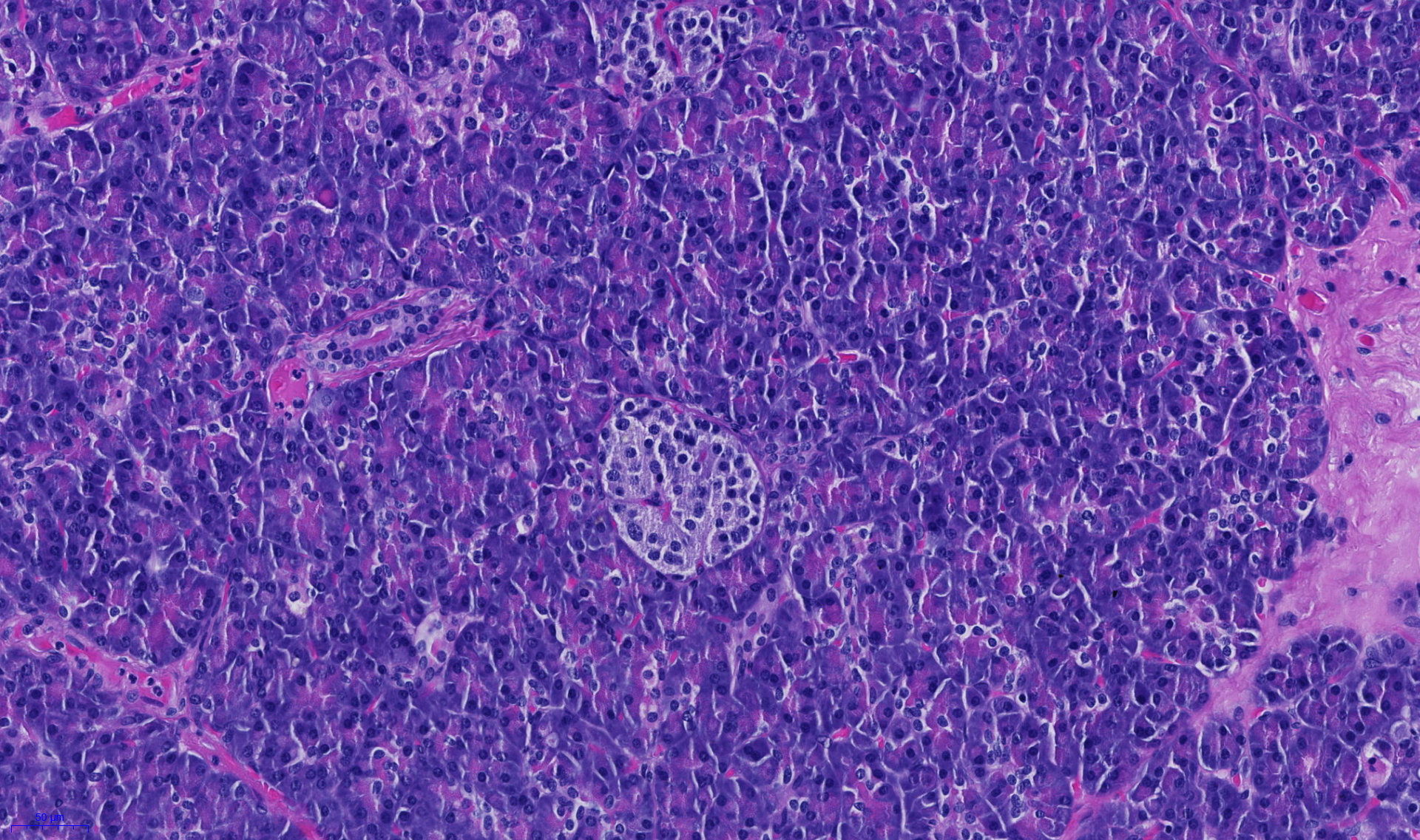 Zellen der Bauchspeicheldrüse, die Insulin produzieren (Mitte). Weisse Blutzellen, die diese schädigen und damit Diabetes auslösen, können auch autoimmune Krankheiten im Darm verursachen. © Universität Bern/Inselspital.