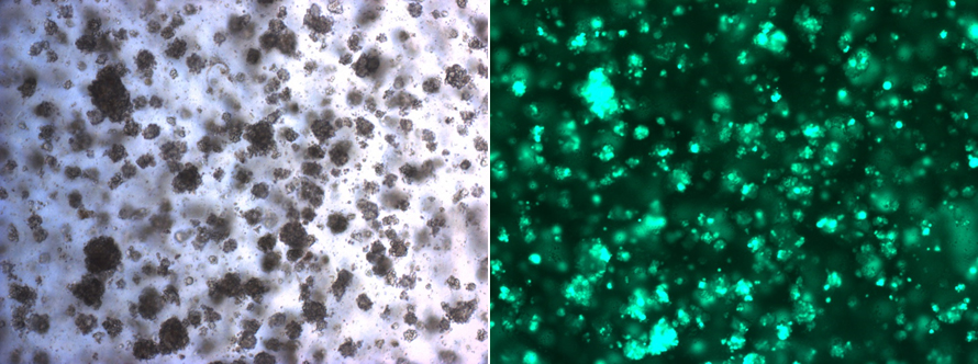 Beispiel einer Kultur von Brustkrebs-Organoiden. Die grünen Zellen in der Fluoreszenzmikroskopie (rechte Seite) sind genetisch modifiziert, um deren Bedeutung für die Entstehung von Krebsresistenzen zu untersuchen. © Universität Bern