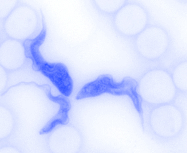 Mikroskopisches Bild (in Falschfarben) von Trypanosoma brucei umgeben von roten Blutkörperchen.
