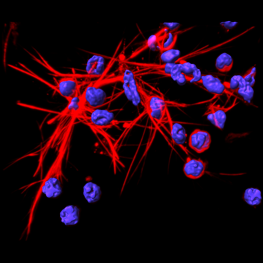 DNA-Netze (rot), die durch Neutrophile aufgestellt werden. Bild: Institut für Pharmakologie/UniBE