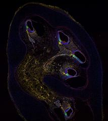 Menschliche Cochlea nach zehn Wochen Entwicklungszeit, immungefärbt zur Identifizierung von Haarzellenvorläufern: «CD271» in gelb, «p27» in grün.  © Marta Roccio und Michael Perny, Inner Ear Research Laboratory, Department for BioMedical Research (DBMR), Universität Bern