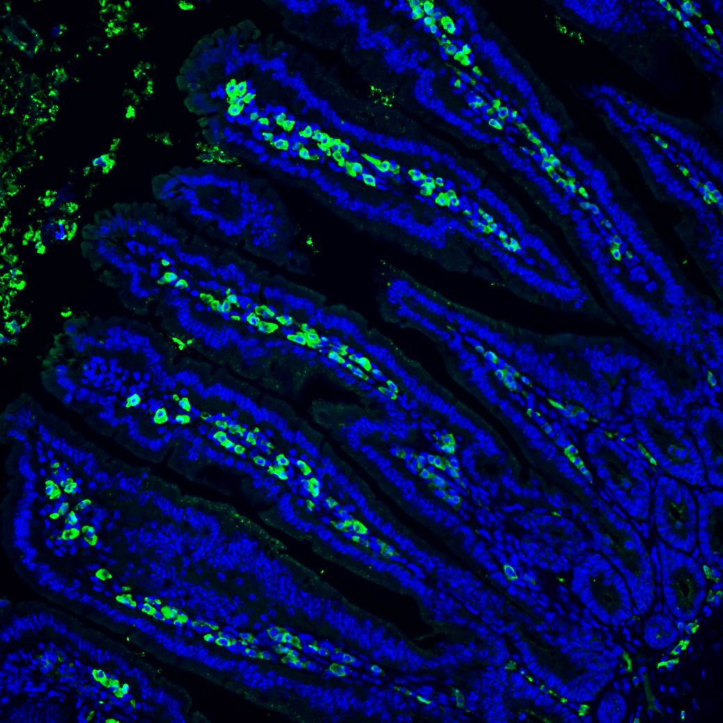 Dünndarmschleimhaut von keimfreien Mäusen mit IgA-produzierenden Plasmazellen (grün). Bild: Brigham & Women’s Hospital, Harvard Medical School