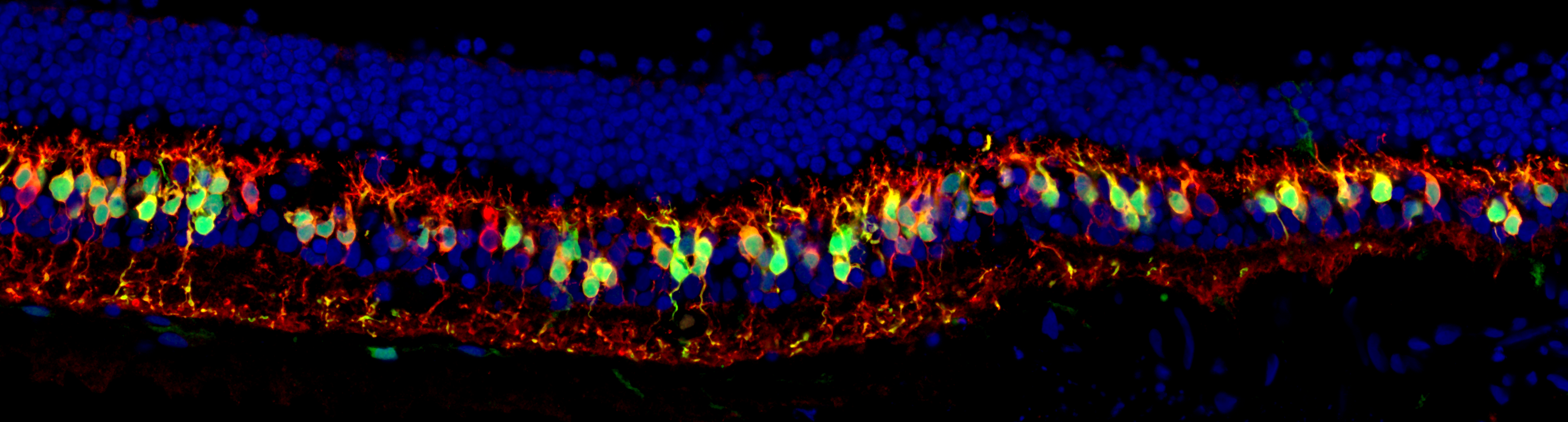 Längsschnitt durch eine humane Netzhaut, die mit einer Opto- mGluR6 behandelt wurde. Die grünen Zellen sind die «neuen» Fotorezeptoren – Nervenzellen der Netzhaut, die durch das Einbringen von Opto-mGluR6 nun Licht wahrnehmen können, so dass auch die blinde Netzhaut wieder «sehen» kann. © zvg