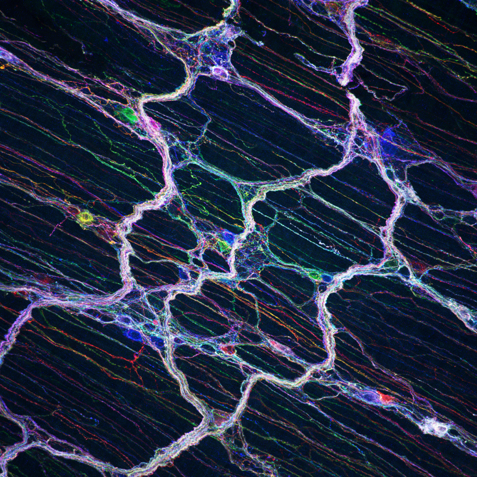Enterisches Nervensystem des Magen-Darm-Trakts, das aus rund 100 Millionen Nervenzellen besteht. © Yuuki Obata and Álvaro Castaño, The Francis Crick Institute
