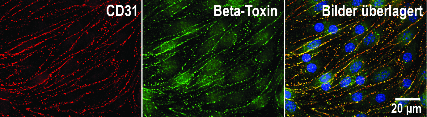 Endothelzell-Kulturen: CD31- (rot) und Beta-Toxin- (grün) Färbungen. Die gelbe Farbe im überlagerten Bild zeigt die identische Verteilung beider Moleküle an den Zellgrenzen. Blau:Zellkerne.   © ITPA